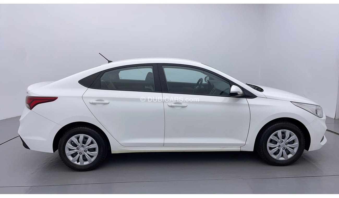 Hyundai Accent GL 1.6 | Zero Down Payment | Free Home Test Drive