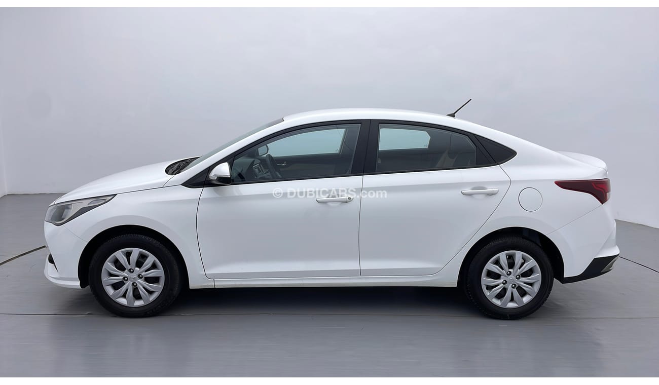 Hyundai Accent GL 1.6 | Under Warranty | Inspected on 150+ parameters