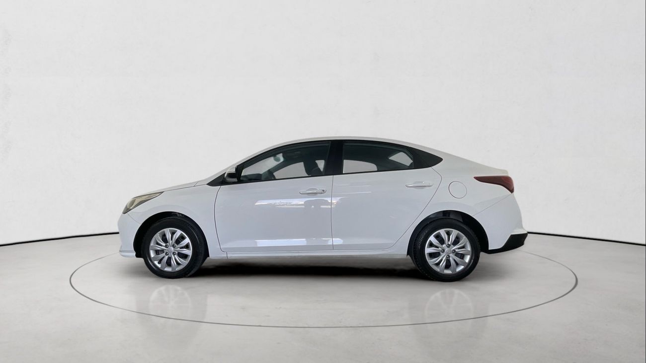 هيونداي أكسنت 1.6 AUTO GL AUTO SMART PLUS | شامل الضمان | 0 ﺪﻔﻋﺓ ﺃﻮﻟﻯ