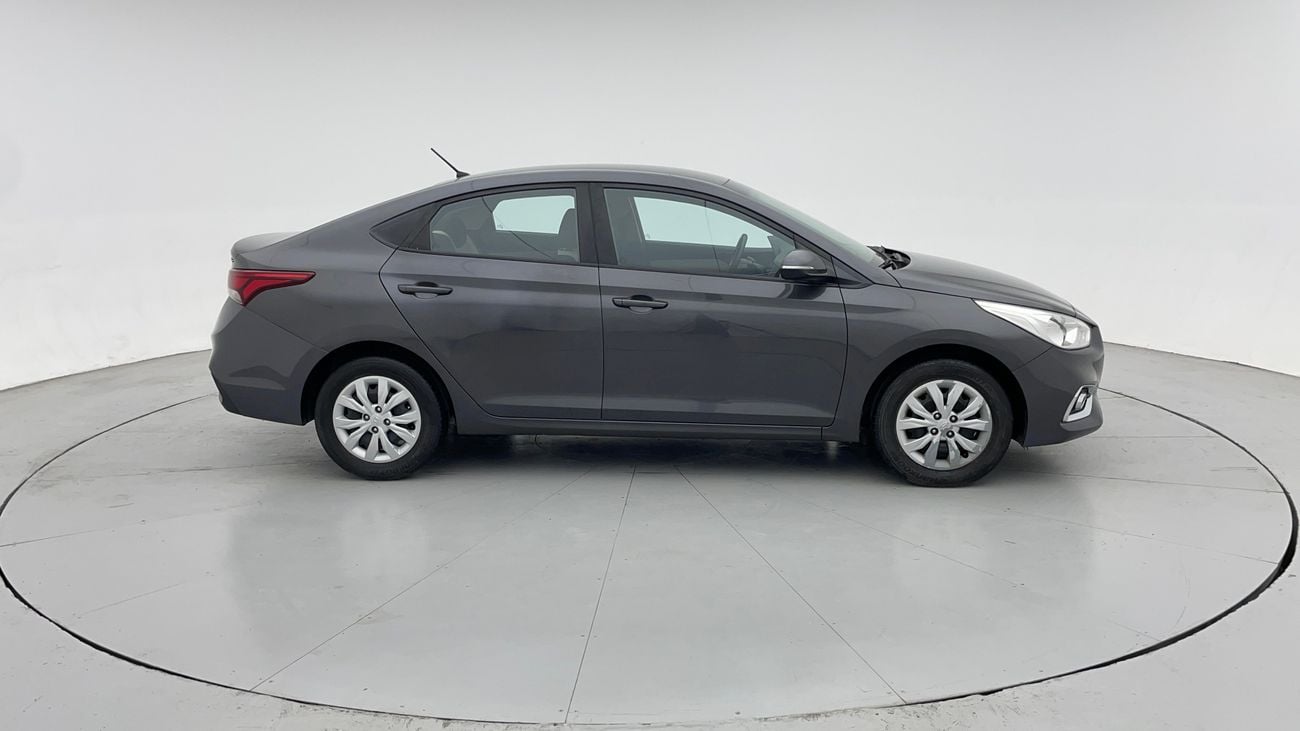 Hyundai Accent GL 1.6 | Zero Down Payment | Free Home Test Drive