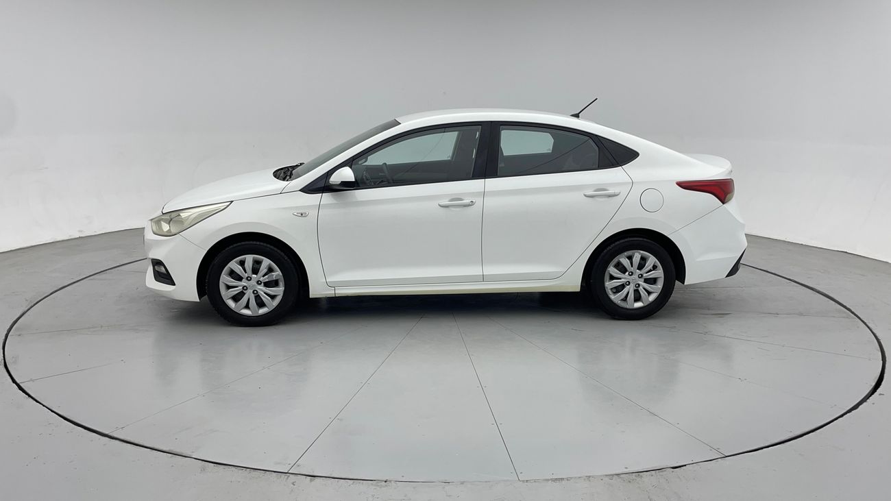 Hyundai Accent GL 1.4 | Zero Down Payment | Free Home Test Drive