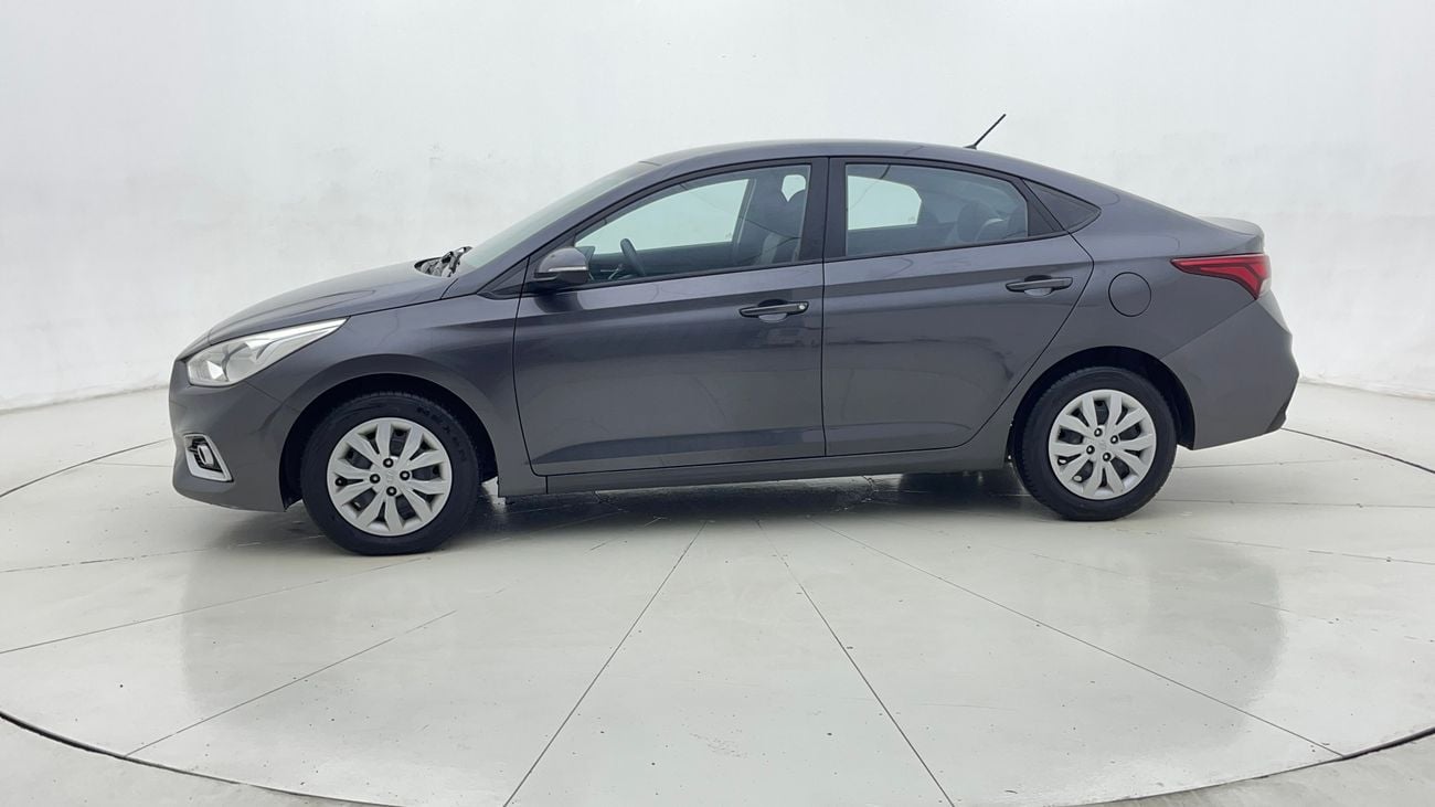 Hyundai Accent GL 1.4L (107 HP) Sedan 2020 GL | AED 400/Month | 0 DP | 30 Day Return | Warranty | Service History