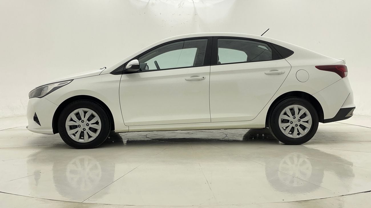 Hyundai Accent SMART 1.6 | Zero Down Payment | Free Home Test Drive