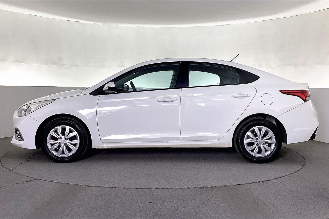 هيونداي أكسنت Smart / GL | شامل الضمان | 0 ﺪﻔﻋﺓ ﺃﻮﻟﻯ