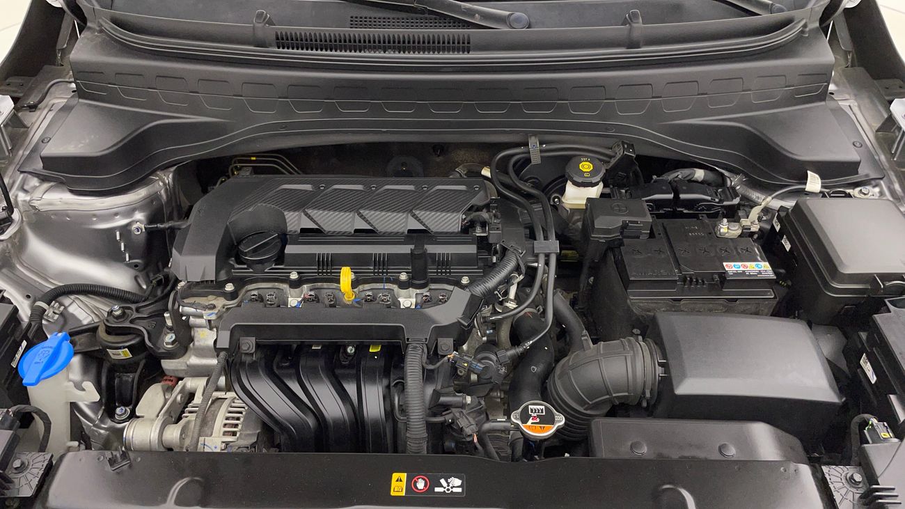 Kia Sonet EX 1.5 | Zero Down Payment | Home Test Drive