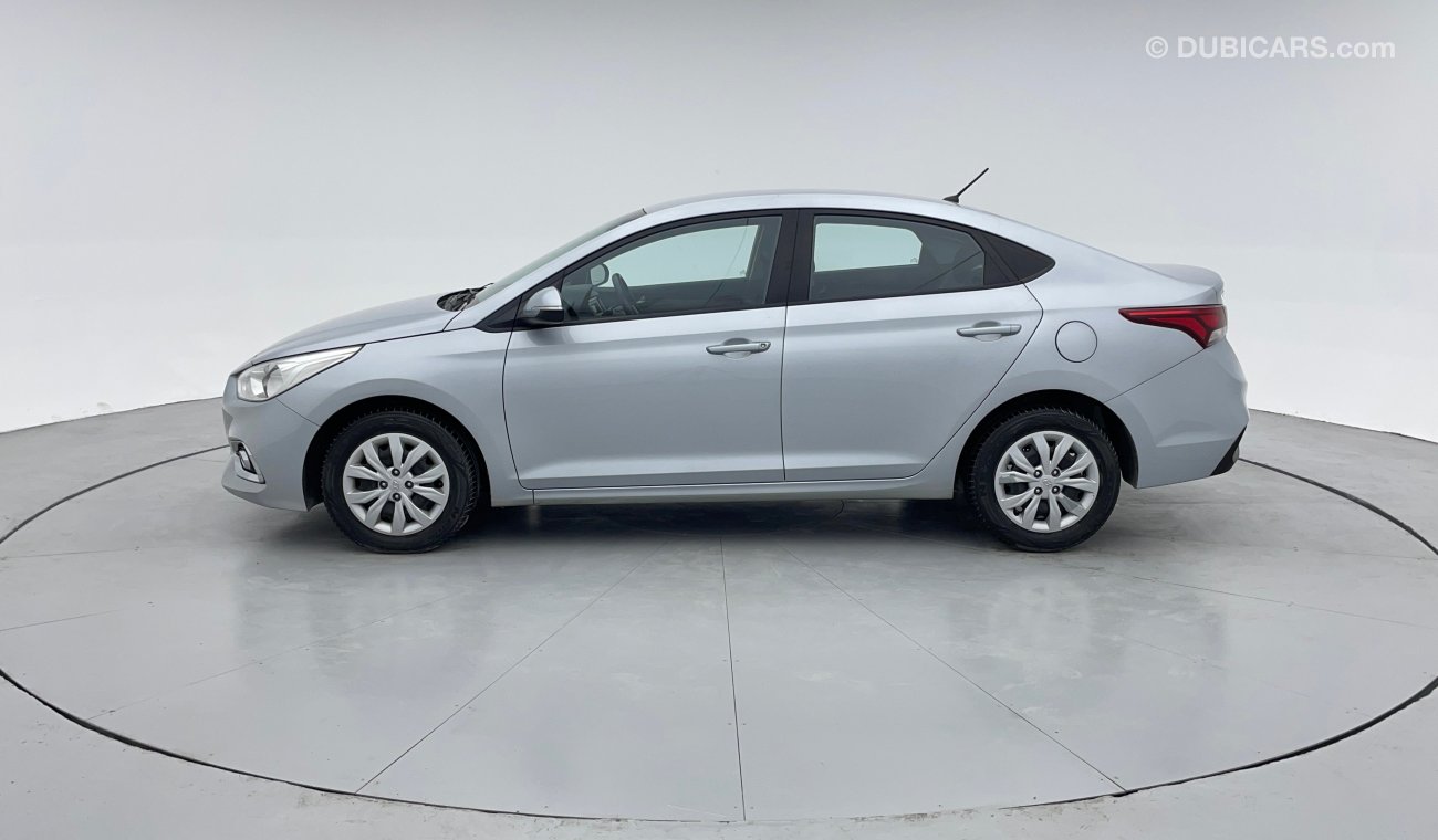 Hyundai Accent GL 1.6 | Zero Down Payment | Free Home Test Drive