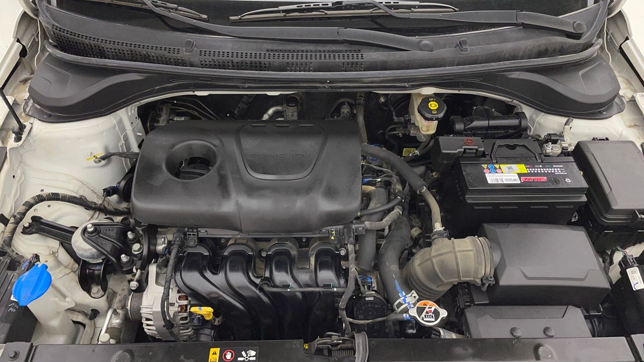 هيونداي أكسنت SMART 1.6 | بدون دفعة مقدمة | اختبار القيادة في المنزل