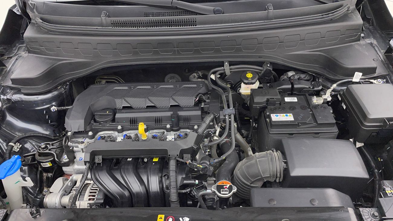 Kia Sonet LX 1.5 | Zero Down Payment | Home Test Drive