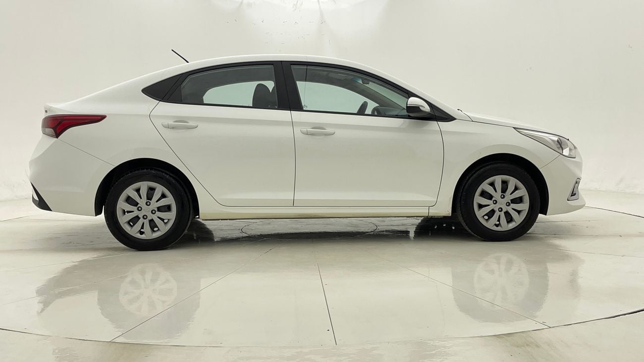 Hyundai Accent SMART 1.6 | Zero Down Payment | Free Home Test Drive