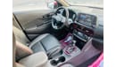 Hyundai Kona GLS Comfort (Red Pack) Sunroof 1.6 red pack
