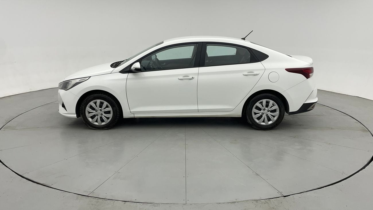 Hyundai Accent GL 1.6 | Zero Down Payment | Free Home Test Drive