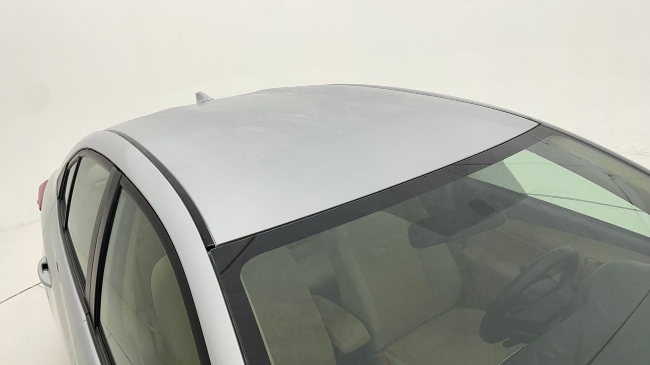 تويوتا يارس SE 1.5 | بدون دفعة مقدمة | اختبار قيادة مجاني للمنزل