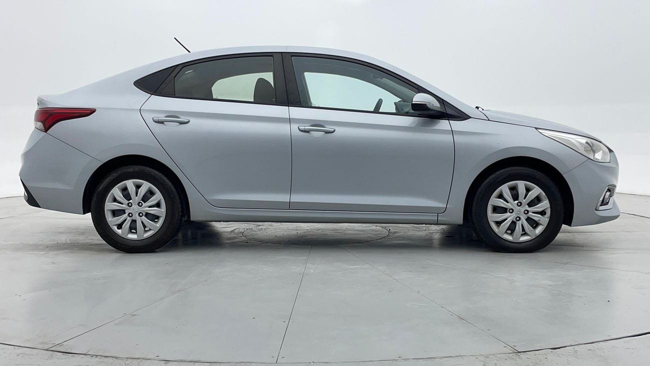 Hyundai Accent GL 1.6 | Zero Down Payment | Free Home Test Drive