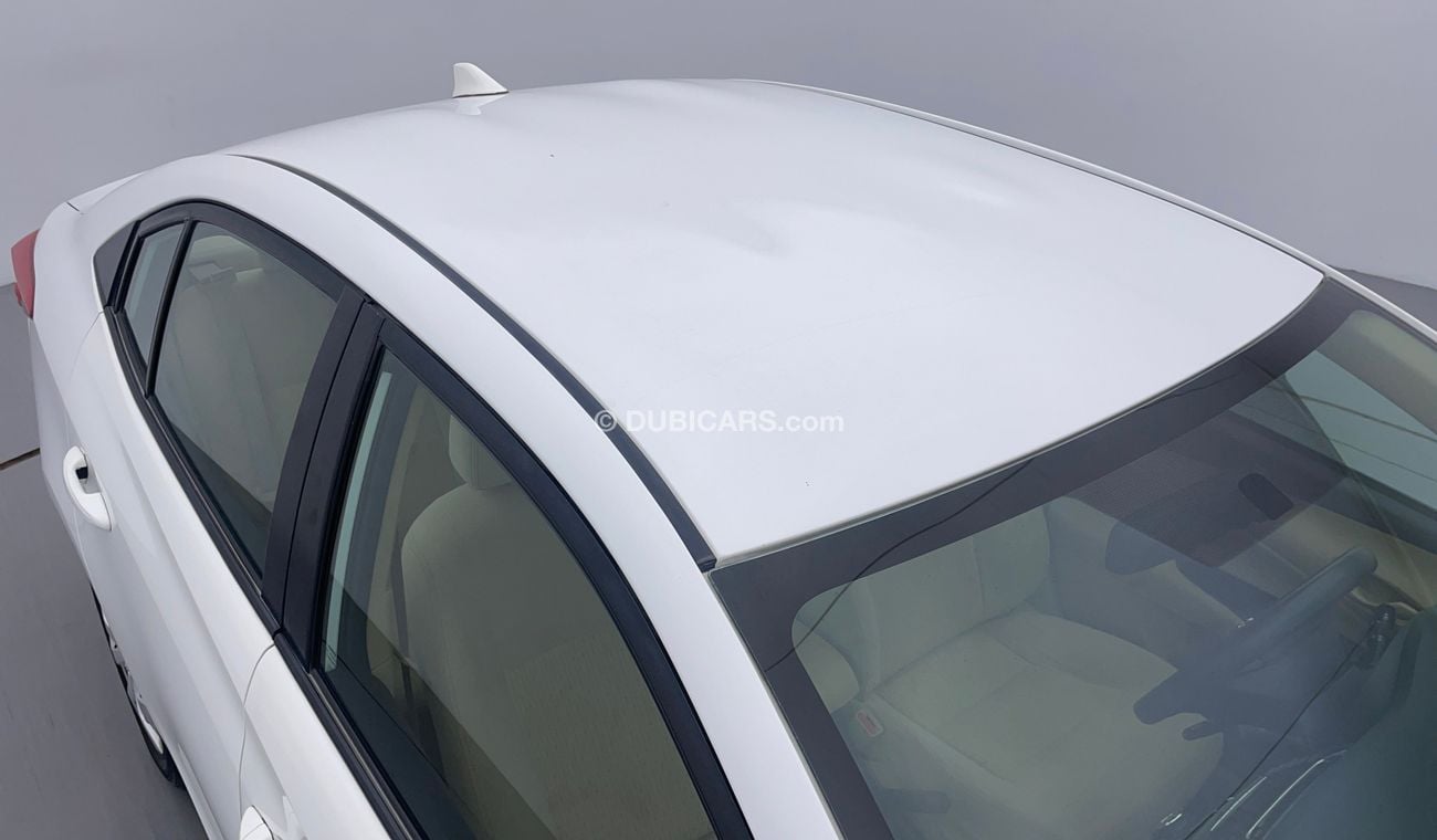 تويوتا يارس SE 1.5 | بدون دفعة مقدمة | اختبار قيادة مجاني للمنزل