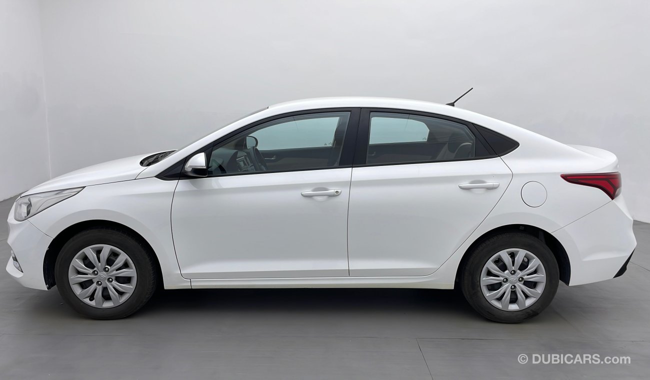 Hyundai Accent GL 1.6 | Under Warranty | Inspected on 150+ parameters