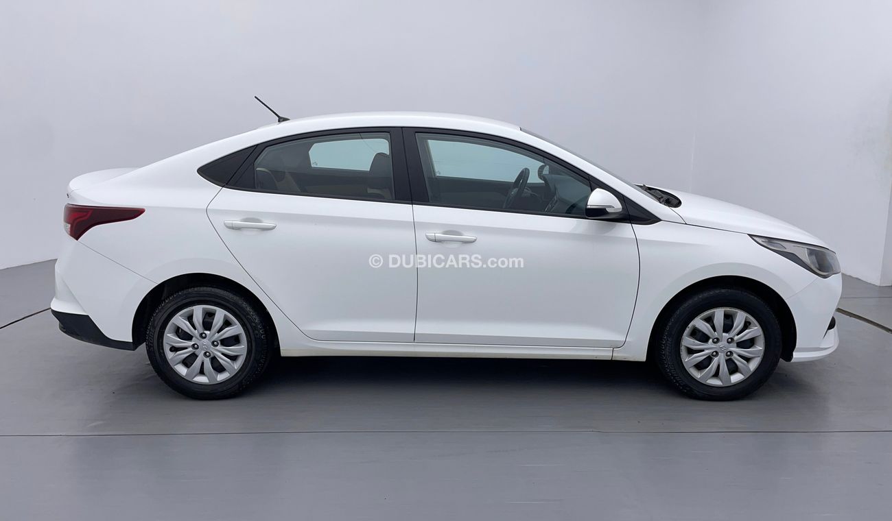 Hyundai Accent GL 1.6 | Zero Down Payment | Free Home Test Drive