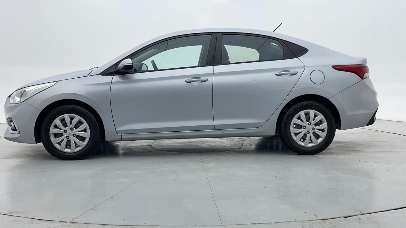 Hyundai Accent GL 1.6 | Zero Down Payment | Free Home Test Drive