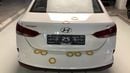 Hyundai Accent GL SMART PLUS 1.6 AUTO GL AUTO SMART PLUS | Guaranteed Warranty | 0 Down Payment