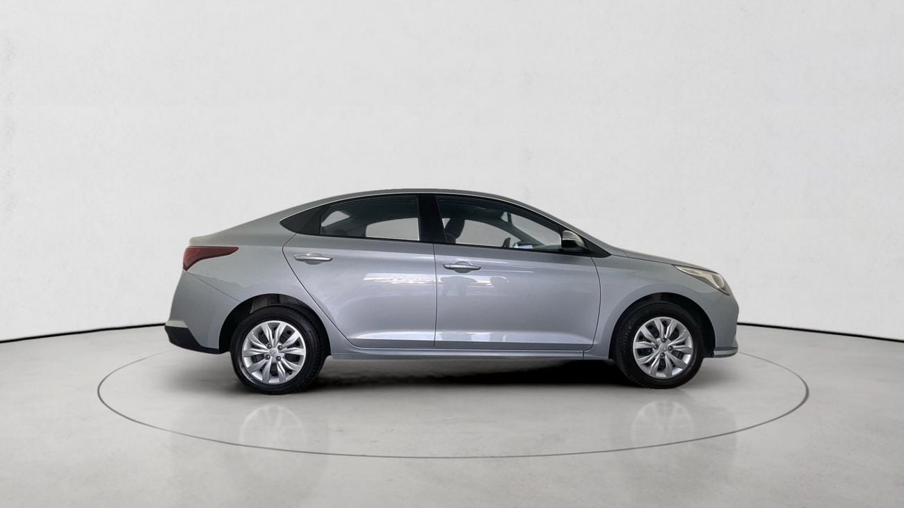 هيونداي أكسنت Smart / GL | upto AED 20,000 Ramadan Discount | شامل الضمان | 0 ﺪﻔﻋﺓ ﺃﻮﻟﻯ