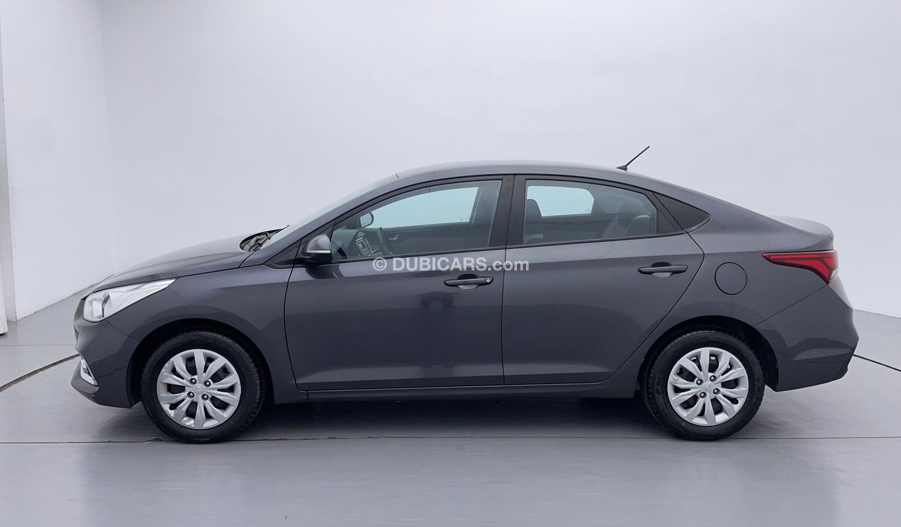 Hyundai Accent GL 1.6 | Zero Down Payment | Free Home Test Drive