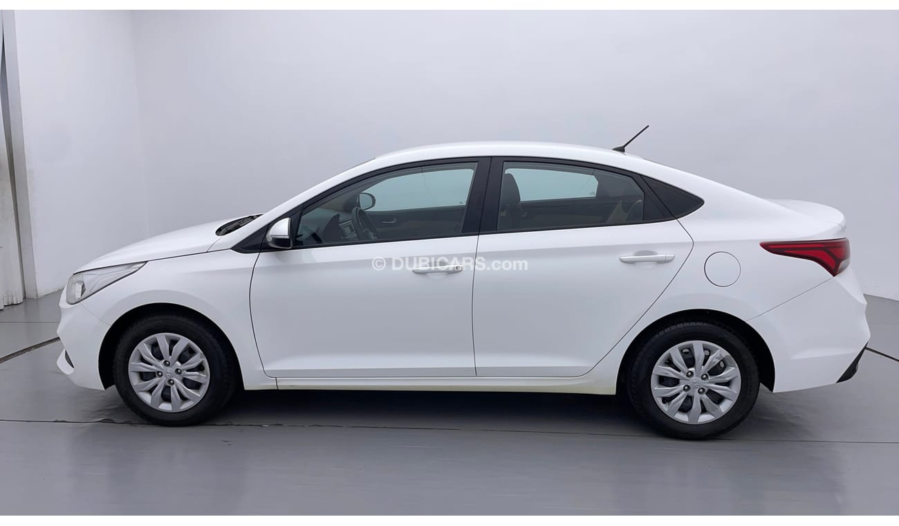 Hyundai Accent GL 1.6 | Zero Down Payment | Free Home Test Drive