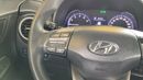 Hyundai Kona 2.0 AUTO GL SMART | Guaranteed Warranty | 0 Down Payment