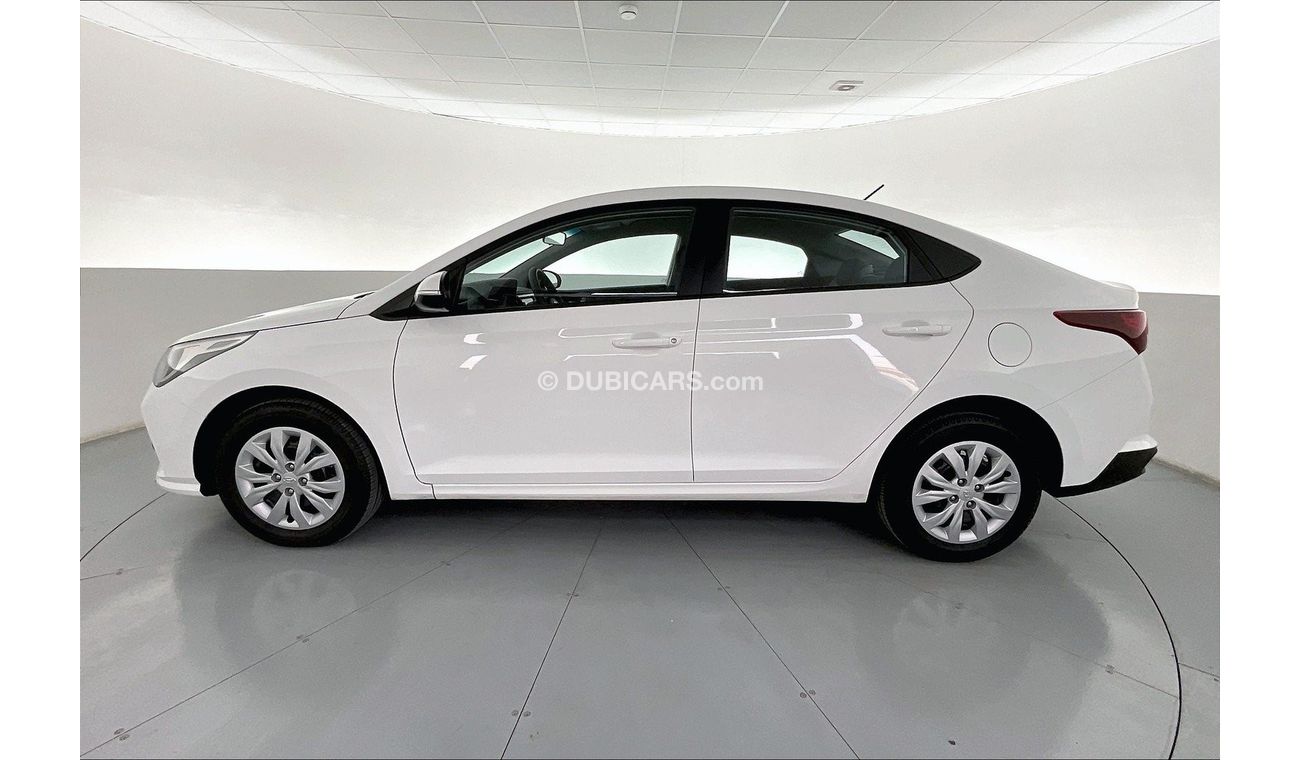 Hyundai Accent Smart / GL | 1 year free warranty | 0 down payment | 7 day return policy