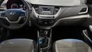 Hyundai Accent SMART 2022 | AED 461/Month | 0 DP | 30 Day Return | Warranty