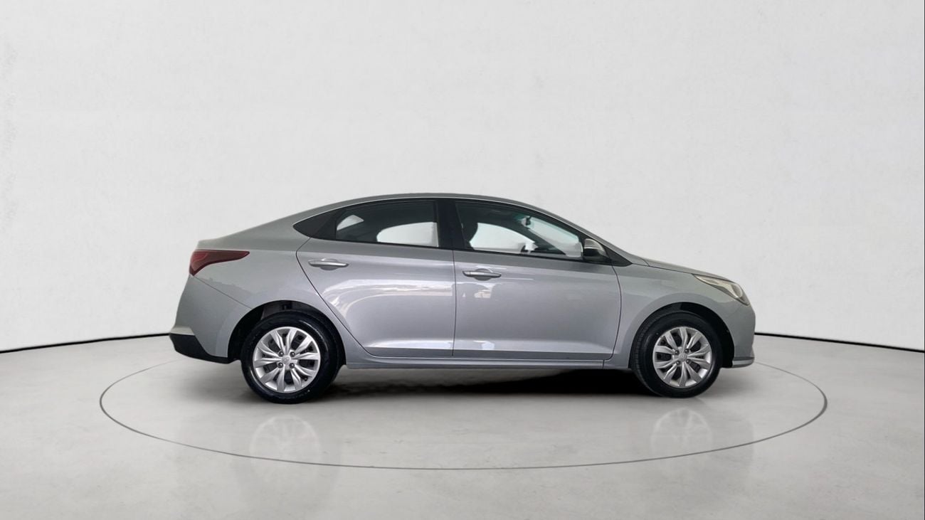 Hyundai Accent Smart / GL | Guaranteed Warranty | 0 Down Payment