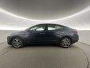 Hyundai Elantra Comfort | Guaranteed Warranty | 0 Down Payment