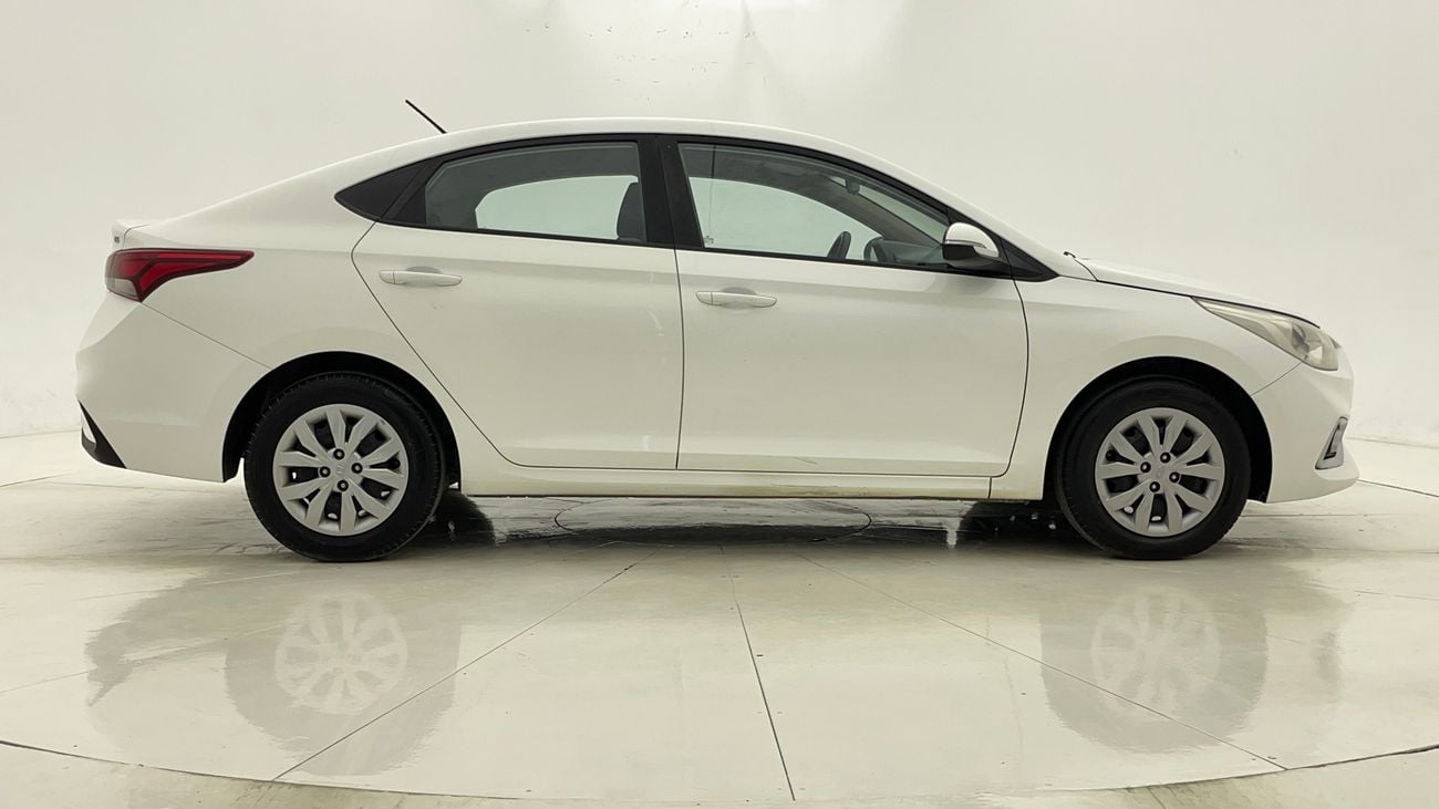 هيونداي أكسنت GL 1.6 | بدون دفعة مقدمة | اختبار القيادة في المنزل