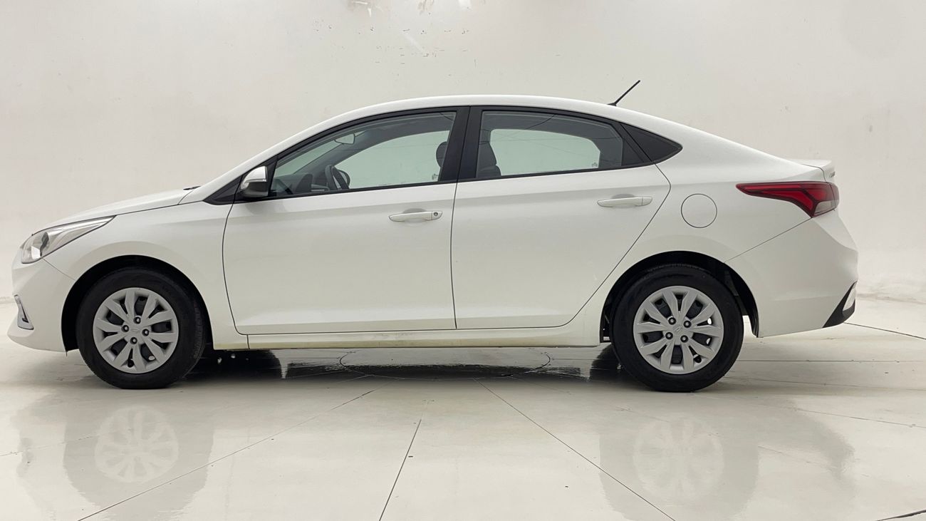 Hyundai Accent GL 1.6 | Zero Down Payment | Home Test Drive