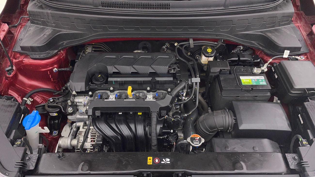 Kia Sonet EX 1.5 | Zero Down Payment | Home Test Drive