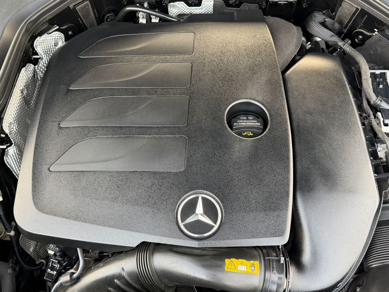 Mercedes Benz E350 E350 KIT AMG