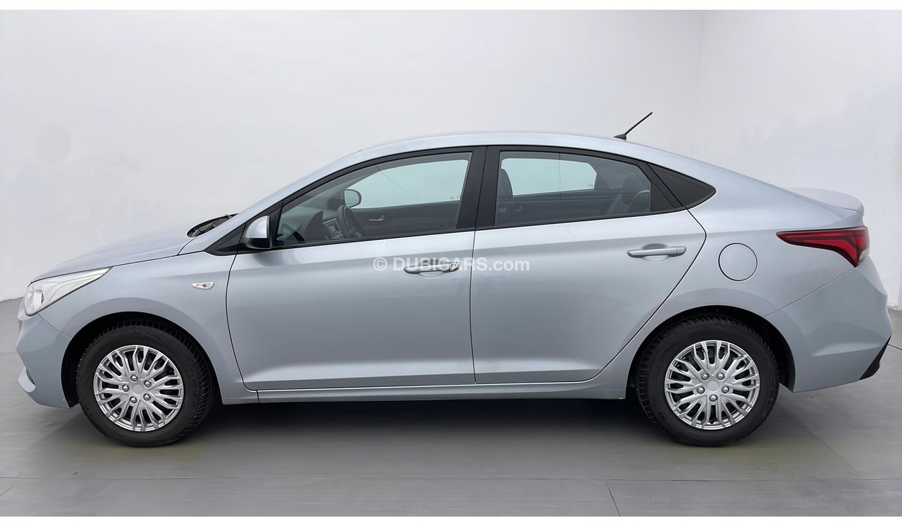 Hyundai Accent GL 1.6 | Under Warranty | Inspected on 150+ parameters