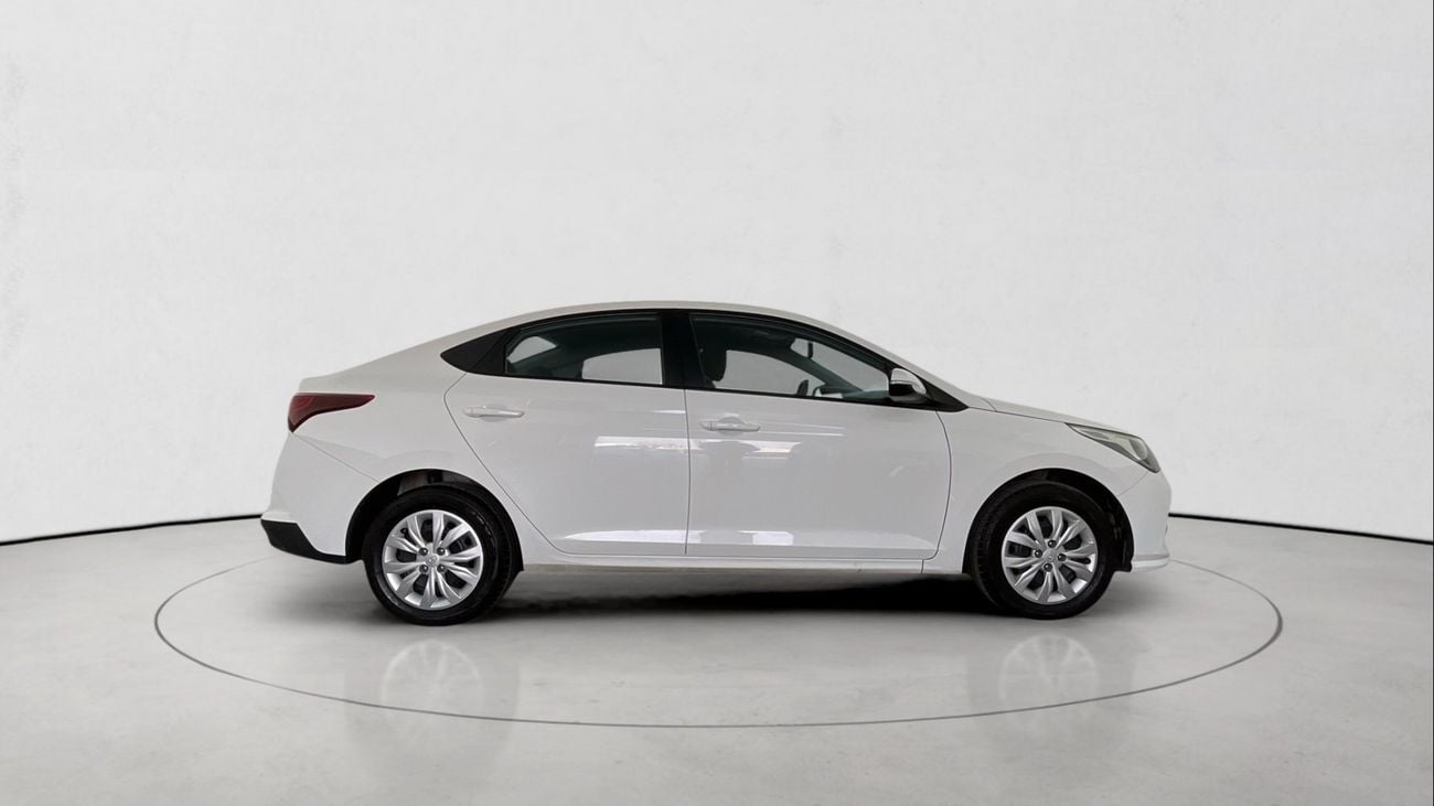 Hyundai Accent Smart / GL | Guaranteed Warranty | 0 Down Payment