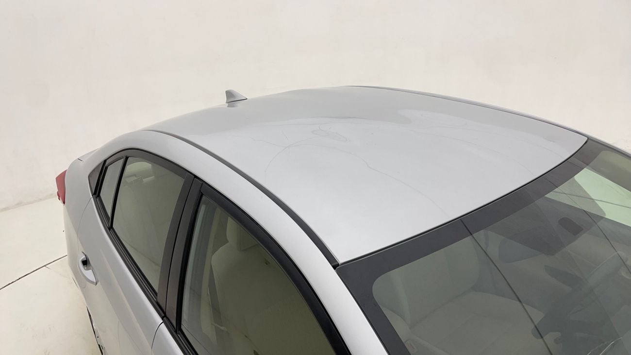 تويوتا يارس SE 1.5 | بدون دفعة مقدمة | اختبار القيادة في المنزل