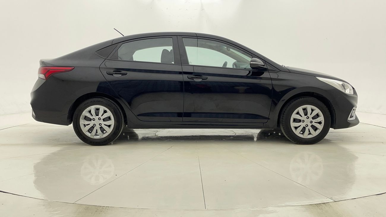 Hyundai Accent GL 1.6 | Zero Down Payment | Home Test Drive