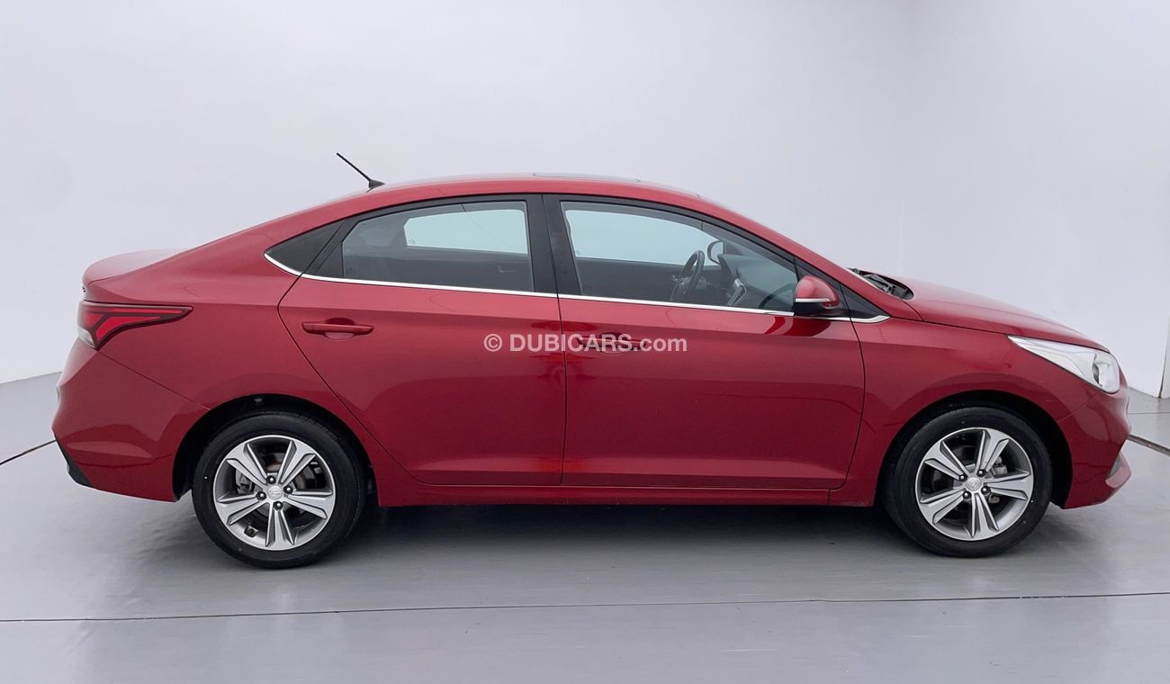 Hyundai Accent GLS 1.6 | Zero Down Payment | Free Home Test Drive