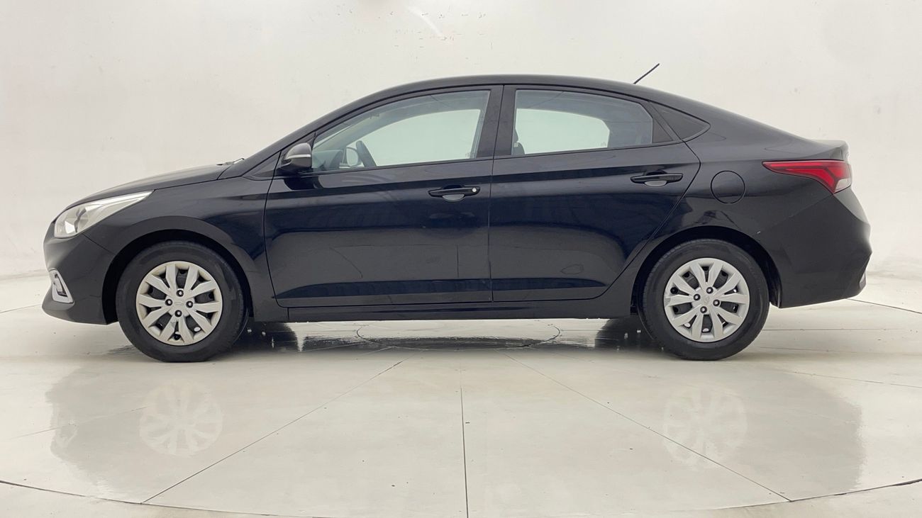 Hyundai Accent GL 1.6 | Zero Down Payment | Home Test Drive