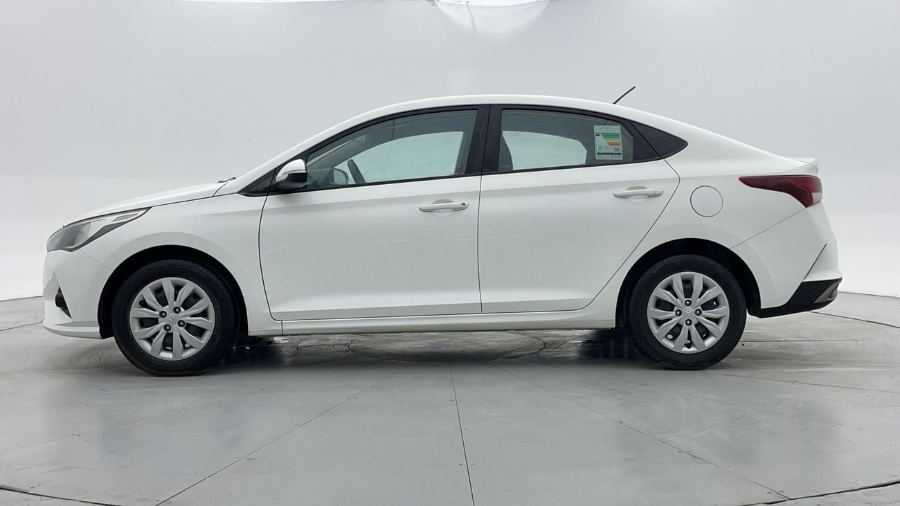 Hyundai Accent SMART 1.6 | Zero Down Payment | Free Home Test Drive