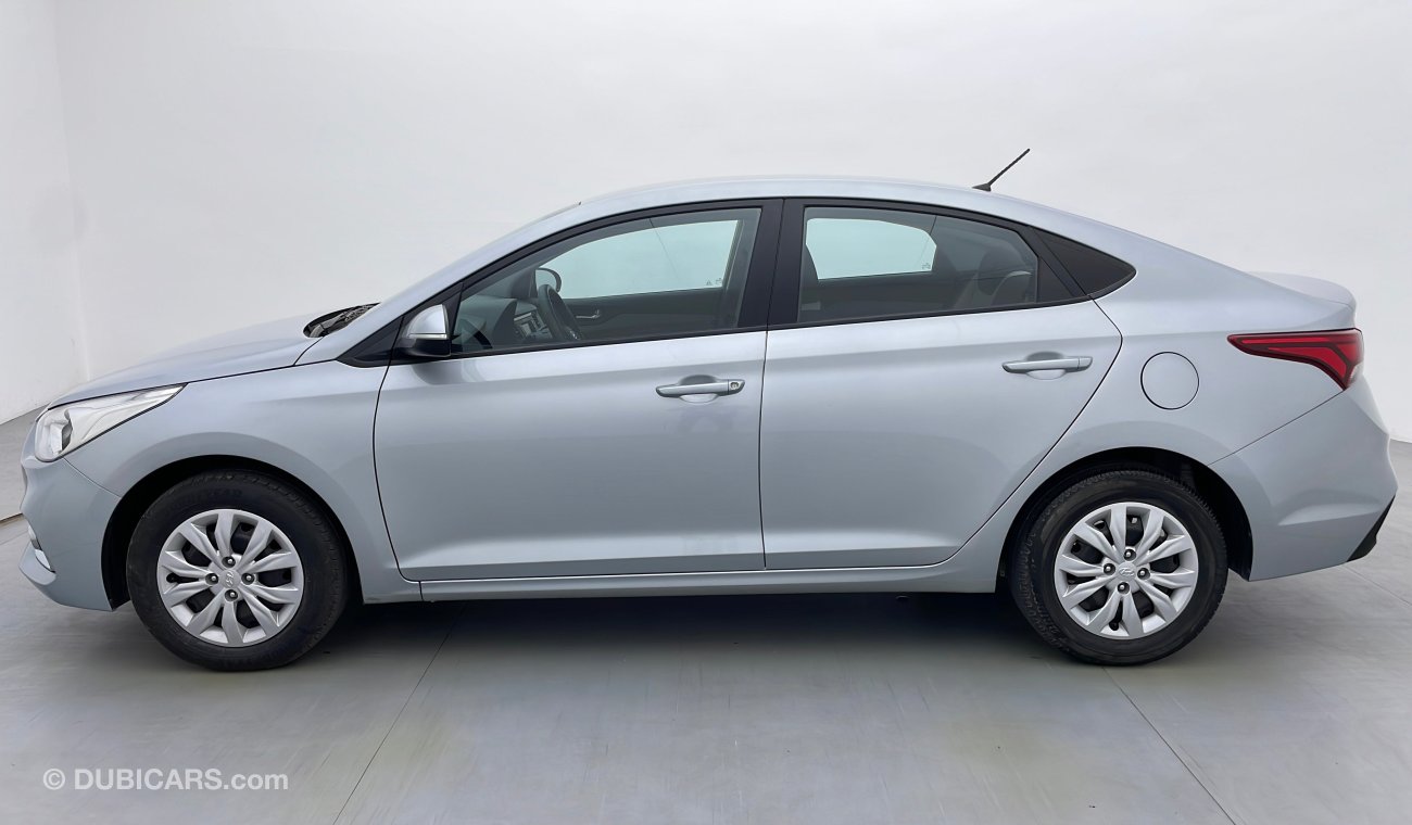 Hyundai Accent GL 1.6 | Under Warranty | Inspected on 150+ parameters