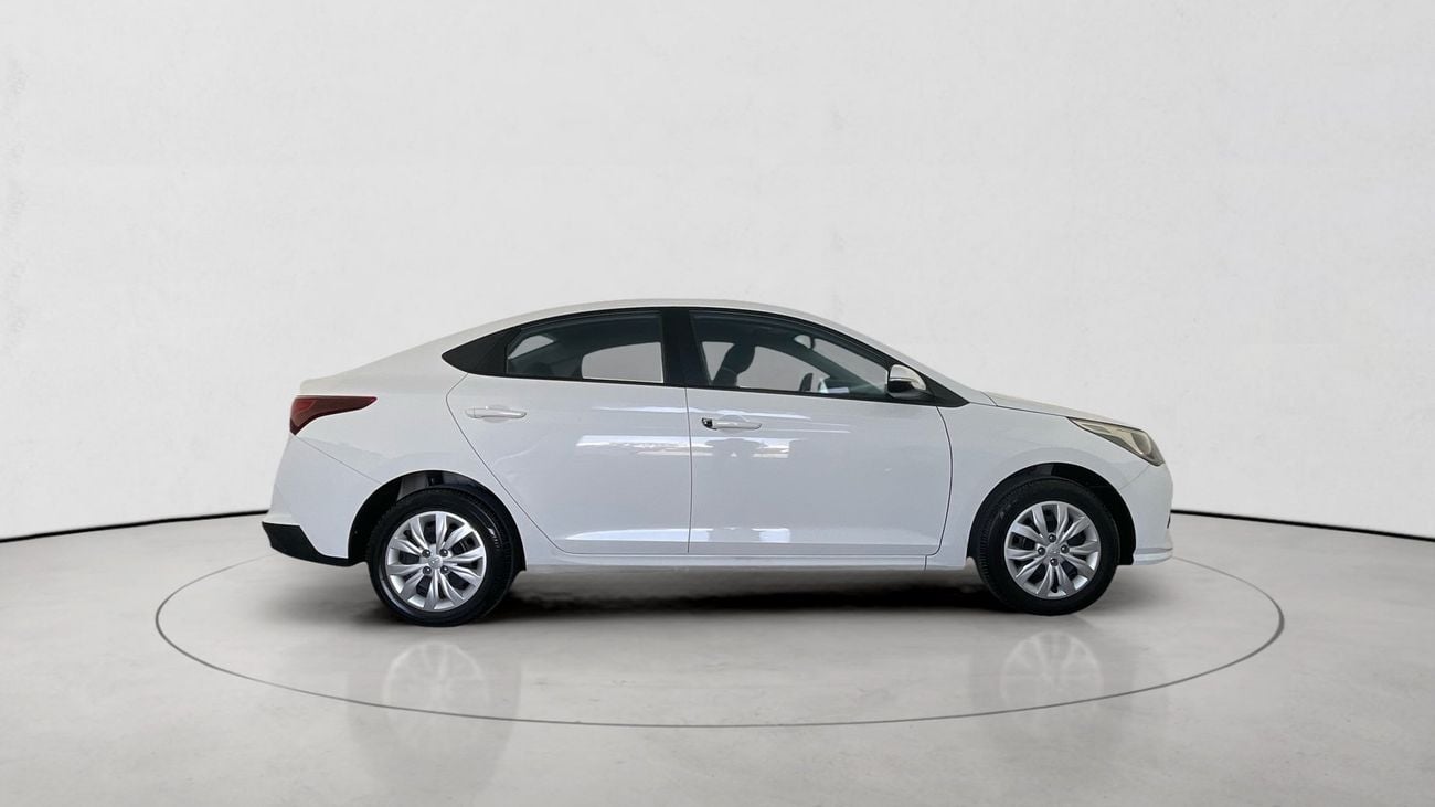 Hyundai Accent Smart / GL | Guaranteed Warranty | 0 Down Payment