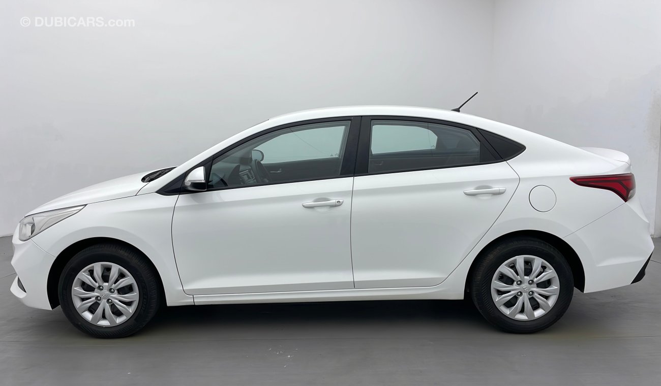 Hyundai Accent GL 1.6 | Under Warranty | Inspected on 150+ parameters