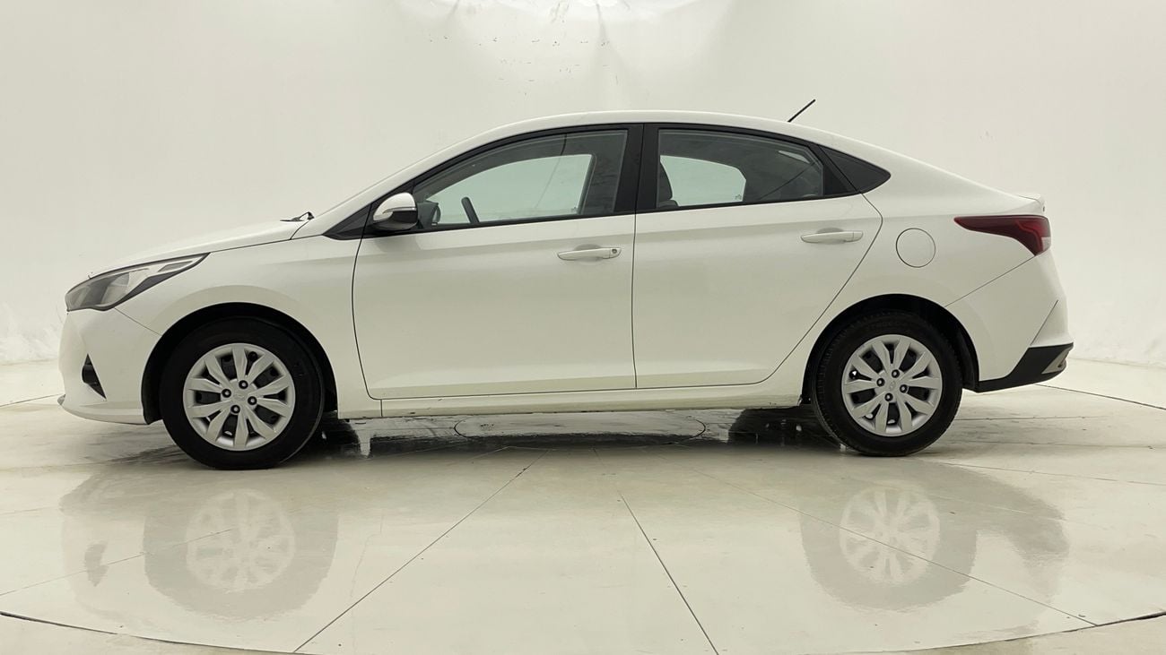 Hyundai Accent SMART 1.6 | Zero Down Payment | Home Test Drive