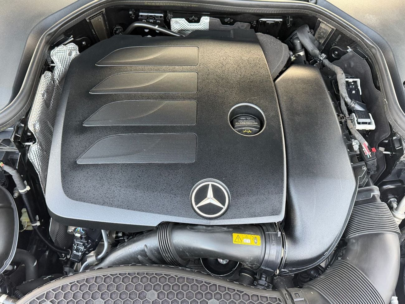 مرسيدس بنز E 350 E350 KIT AMG