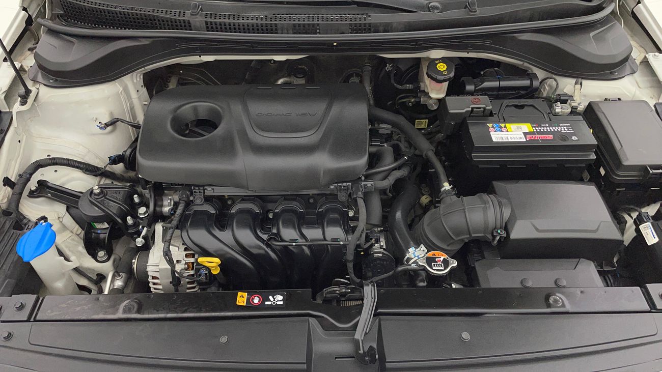 هيونداي أكسنت SMART 1.6 | بدون دفعة مقدمة | اختبار القيادة في المنزل