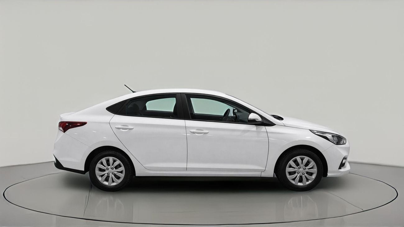 Hyundai Accent SMART 2022 | AED 461/Month | 0 DP | 30 Day Return | Warranty