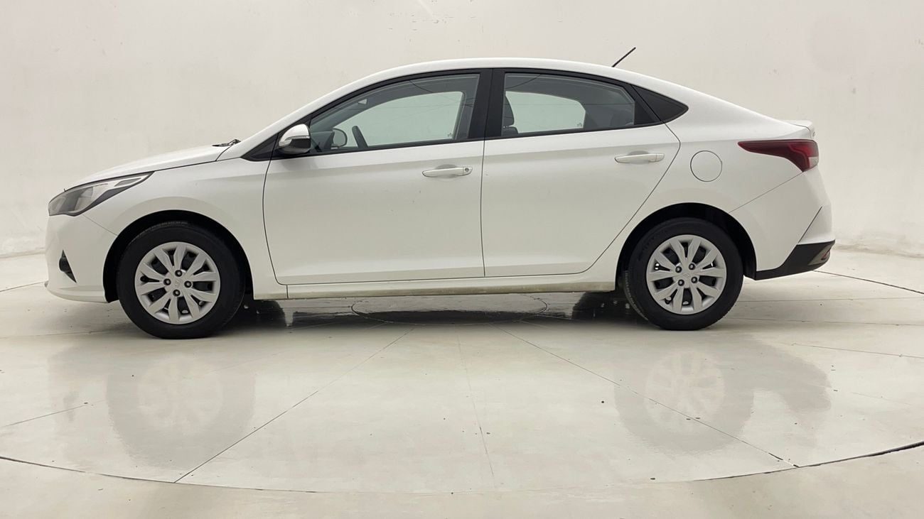 Hyundai Accent SMART 1.6 | Zero Down Payment | Home Test Drive