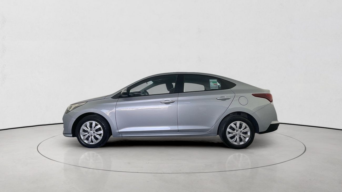 هيونداي أكسنت Smart / GL | upto AED 20,000 Ramadan Discount | شامل الضمان | 0 ﺪﻔﻋﺓ ﺃﻮﻟﻯ